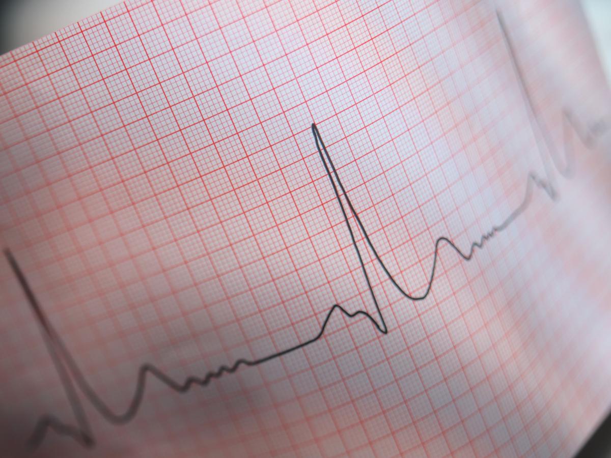Roma, ECG e Holter nelle farmacie per ridurre le liste d’attesa