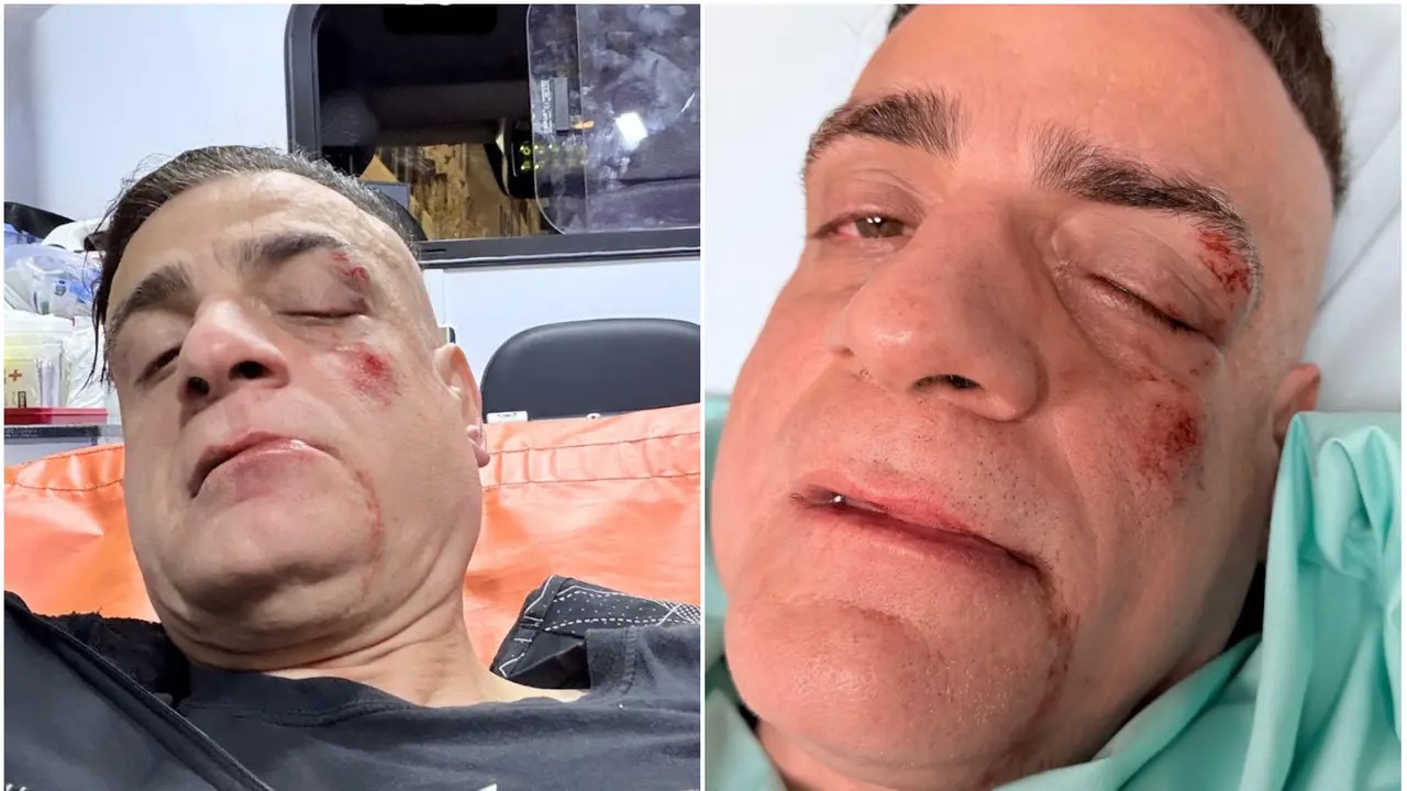 Roma, aggressione brutale contro lo Youtuber Cicalone: è in ospedale